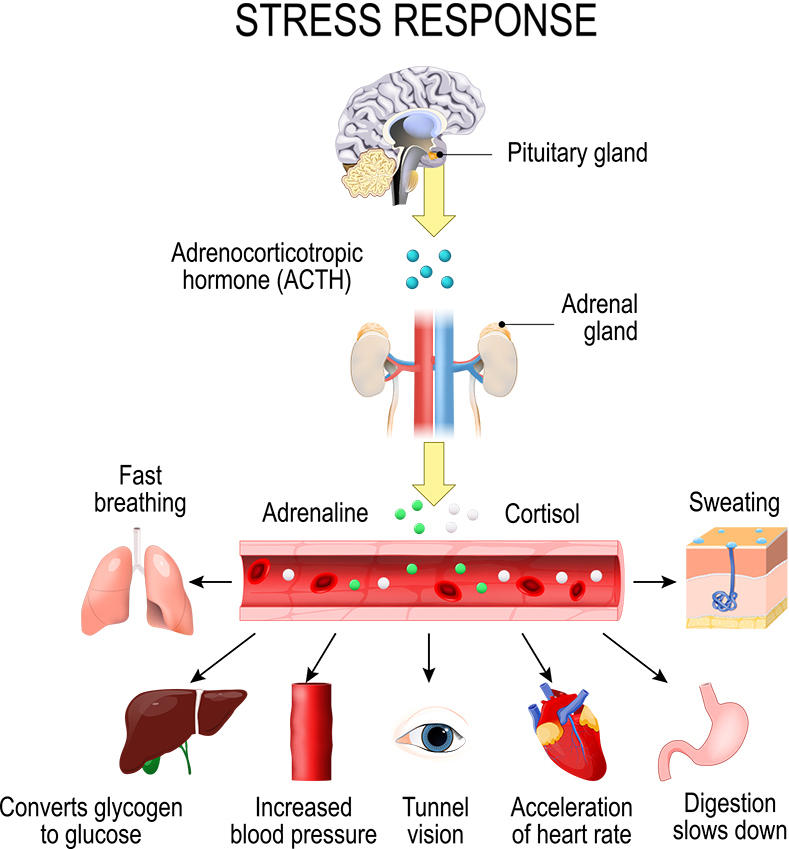 updated-stress-diagram